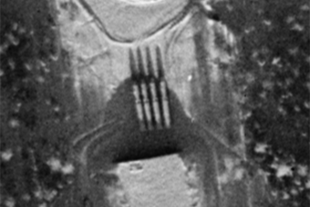 Fascinating Declassified Satellite Images from the Archive: 2025